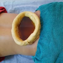 Kati Basti therapy — warm medicated oil held over the joint